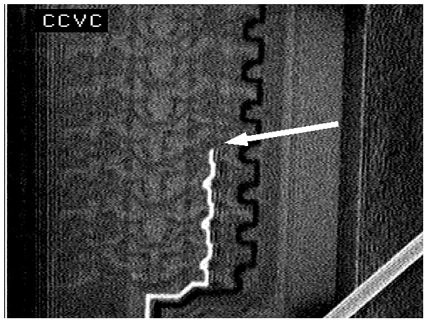 CCVC image showing an averaged 16 frame image of an open conductor in an SRAM. (Courtesy Sandia Labs).